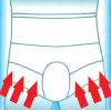 Unterhose nach der Operation hernioplasty für Herren