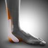 Achilles tendon ankle brace Achillo-Hit
