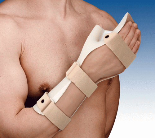 Hand brace of rest wrist-hand-fingers-thumb Thermo-Cast 1