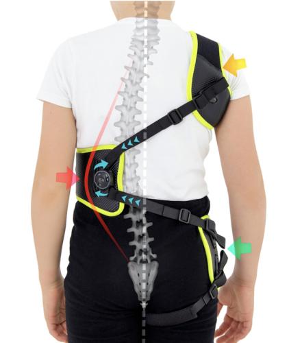 Active scoliosis correction corset for children