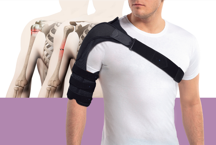 Shoulder brace-support indicated for humerus lesions goural EVOH300 :   - Orthopédiste-Orthésiste à Montargis. Orthèses de main  thermoformables et corsets sur-mesure.